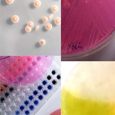 mikrobiol Eukariotu molekulines mikrobiologijos laboratorija